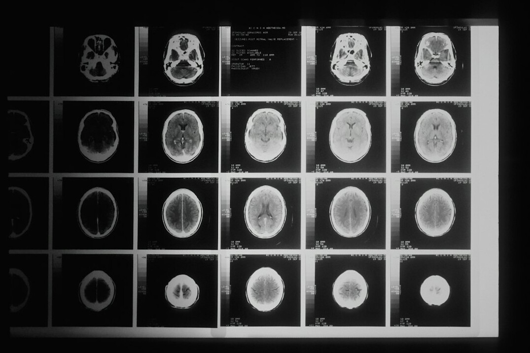 medical ai scan